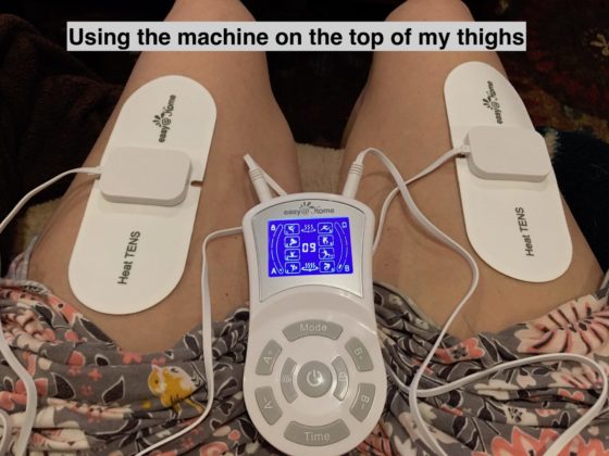 A TENS machine being used on a woman's thighs. It is captioned "Using the machine on the top of my thighs."