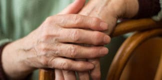 Woman's Hands Rheumatoid Arthritis