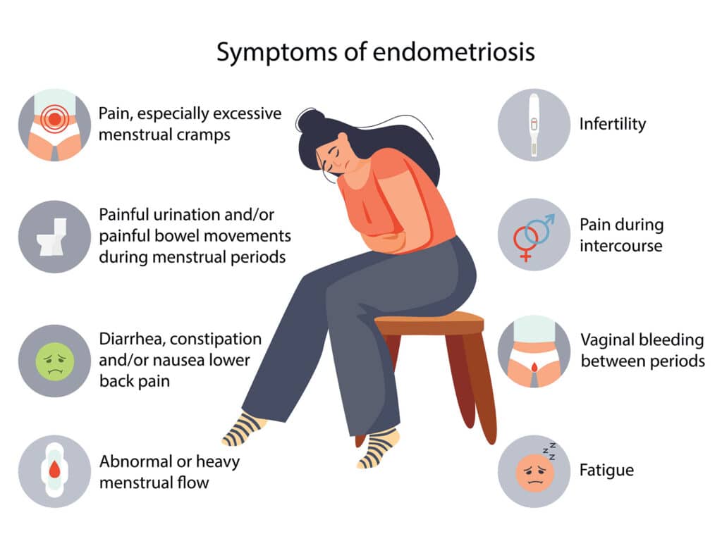 Symptoms of an Endometriosis