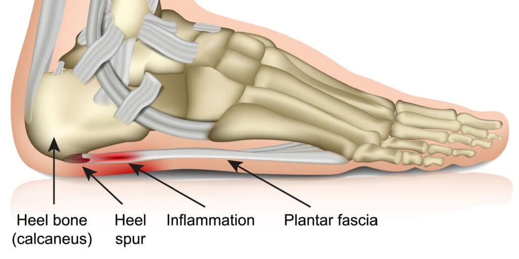 Understanding the Plantar Fascia 