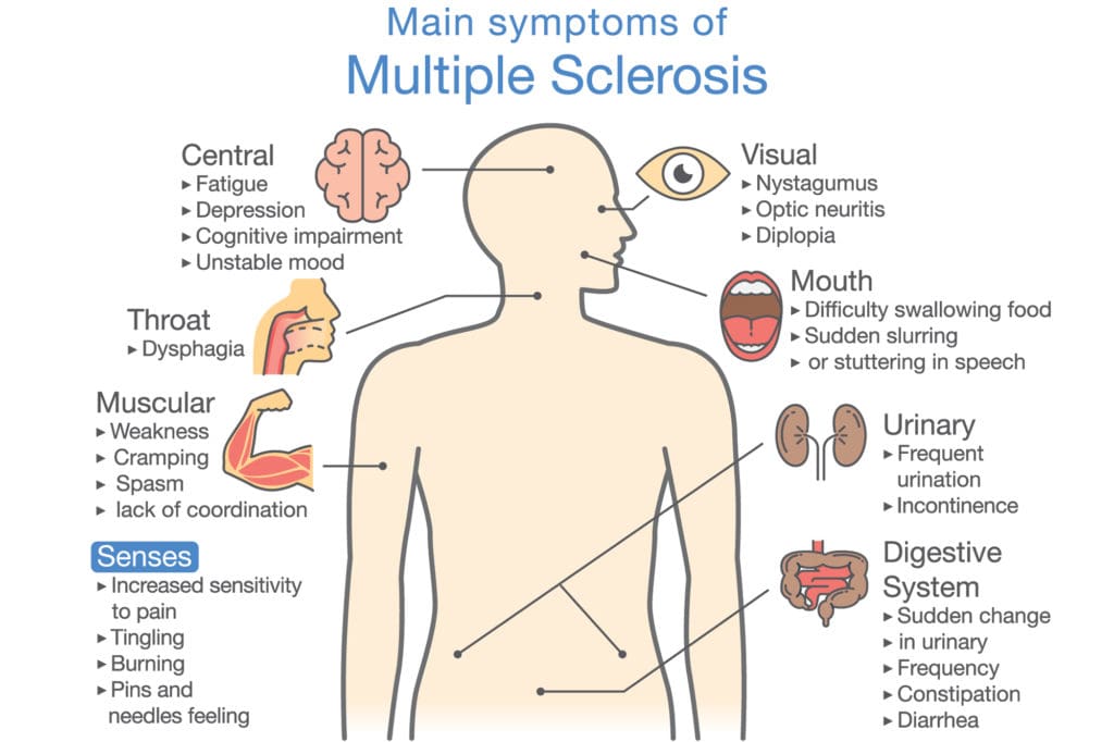 What Is Multiple Sclerosis