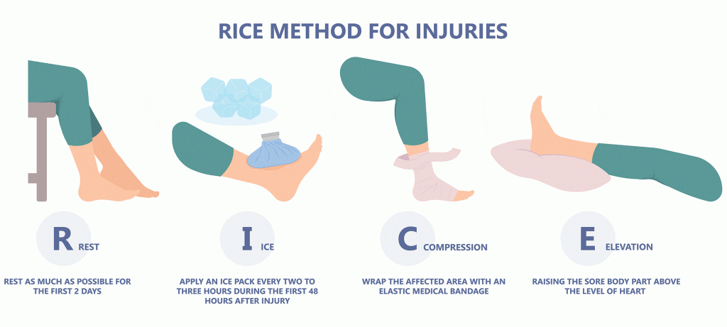 Treating Sprains and Strains Rice Infographic