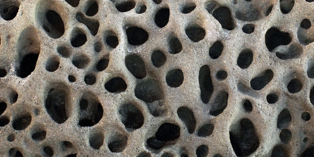 What Causes Trypophobia?
