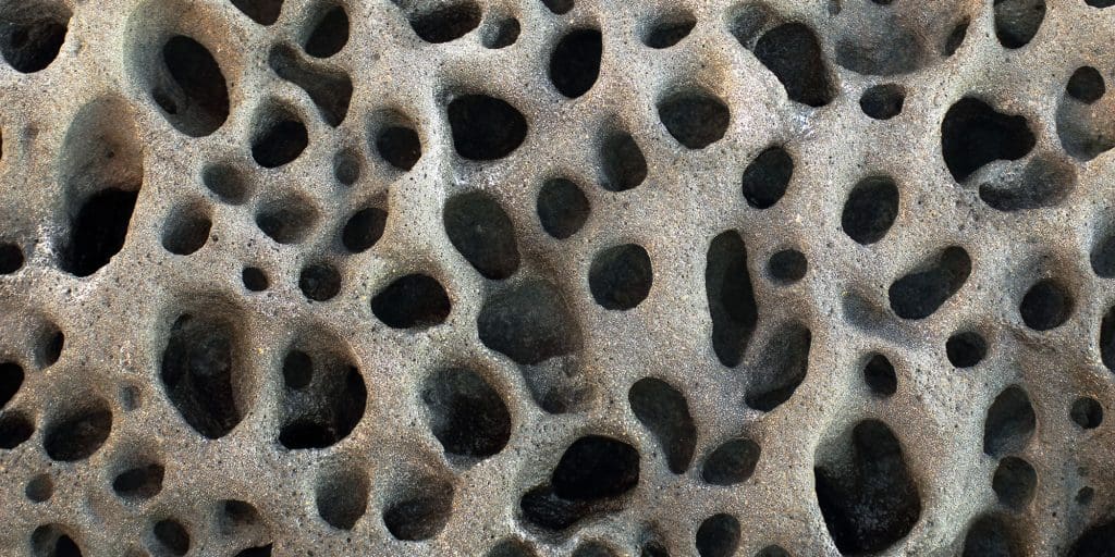 Trypophobia Treatment