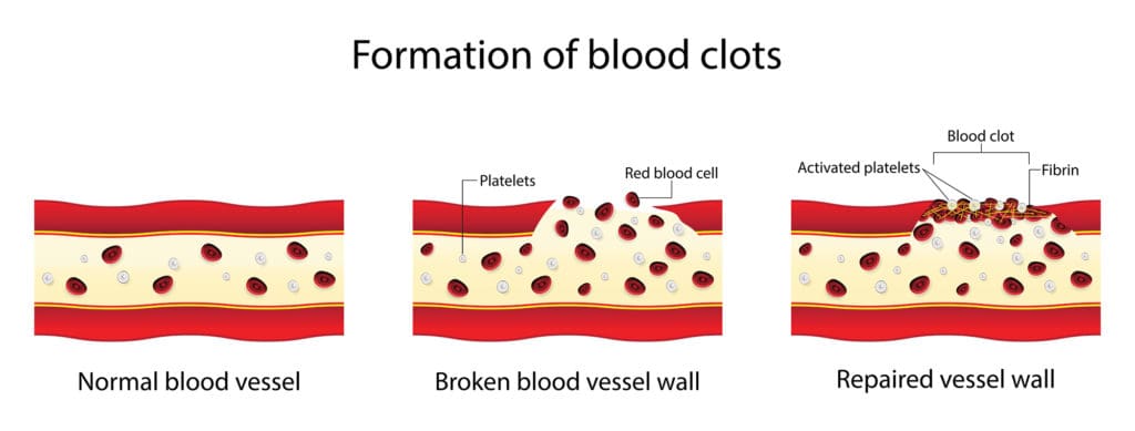 Blood Clotting