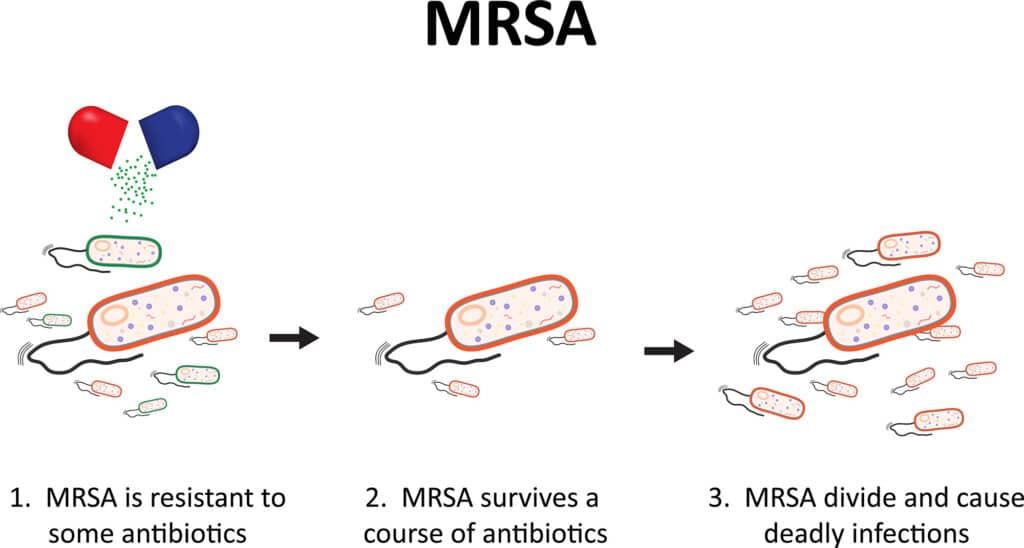 Mrsa infographic