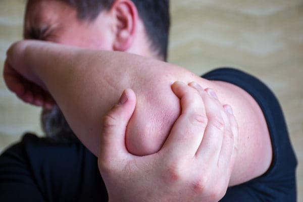 rheumatoid arthritis elbow pain with RA