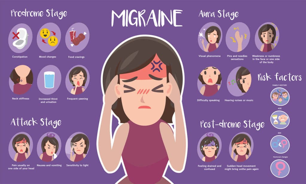 stages of Prodrome Migraine