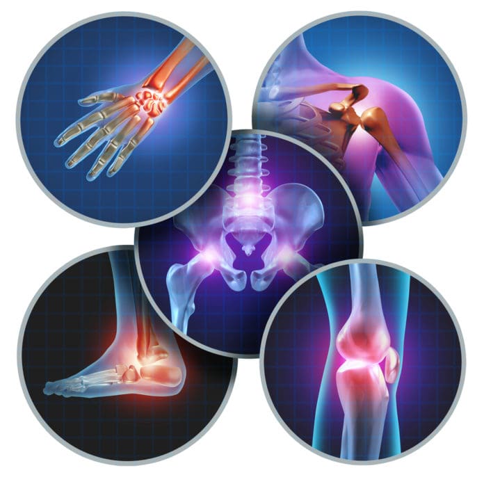 There are various 3D images of body parts that are radiating joint pain. These include the shoulder, ankle, wrist, knee, and parts of the spine.